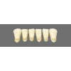 Široké zuby Klasická čela 6 ks Super cenová akce