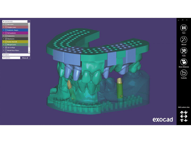 Modul Exocad Model Creator (modely pro 3D tisk)