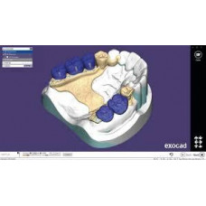 Modul Exocad Částečná zubní protéza (kostry)