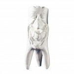 Hinrichova sbírka zubů ''Rudi'' sádrové zuby