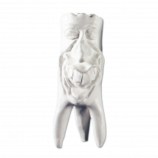 Sádrové zuby Hinrichsova sbírka zubů '' Rudi ''