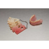 Formlabs resin Denture Base 1L - Pryskyřice pro zubní protézy