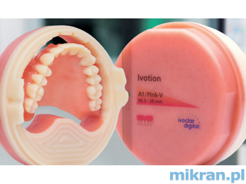Ivotion Pink-V 98,5U / 38mm horní zubní náhrada
